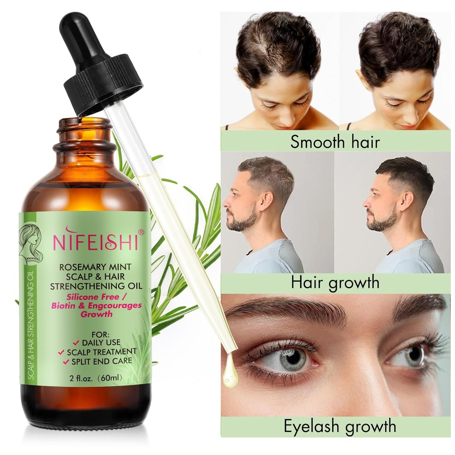 NIFEISHI Rosemary Oil for Hair Growth, Rosemary Mint Scalp & Hair Strengthening Oil, Multipurpose Rosemary Essential Oils for Hair Growth, Eyebrow, Eyelash & Skin